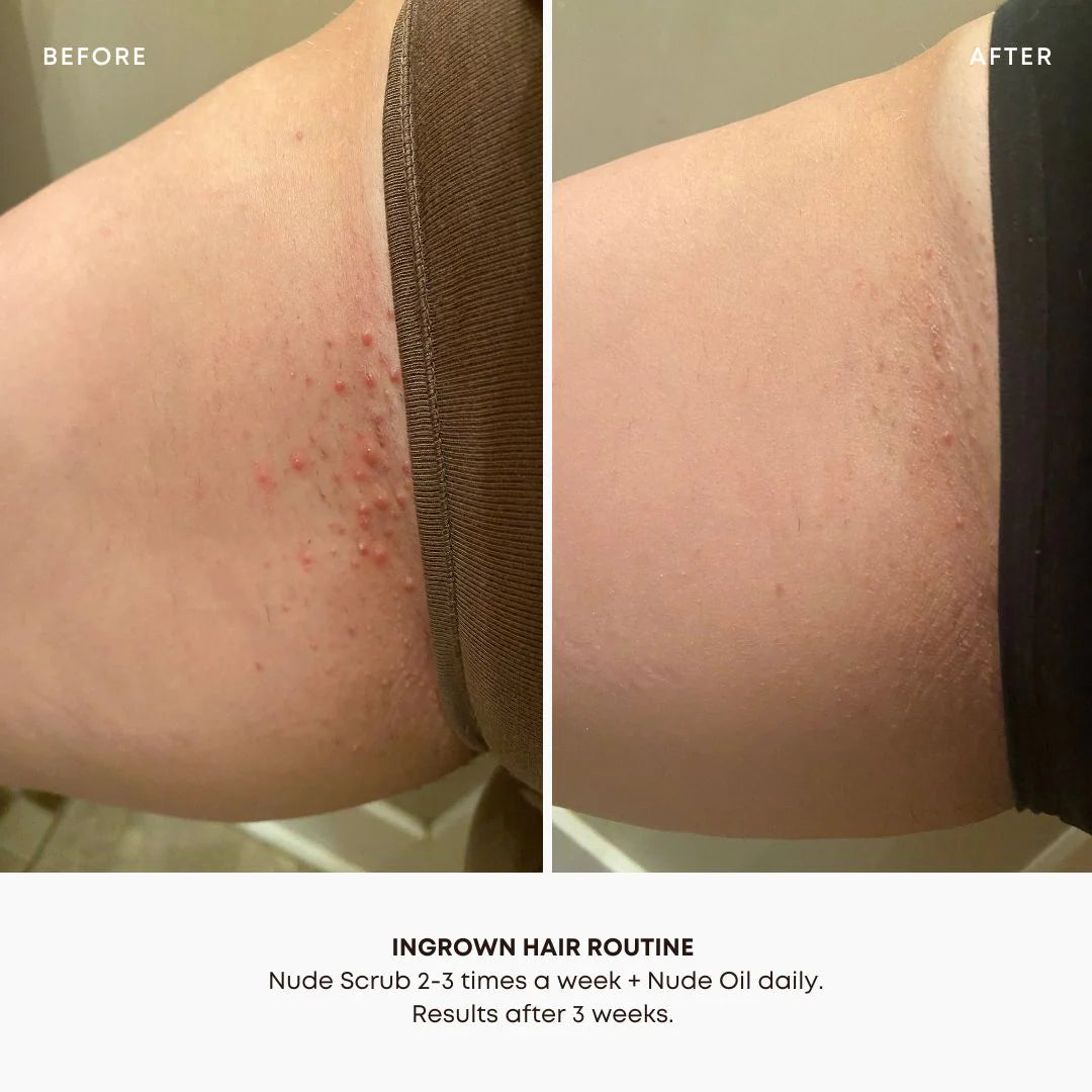 Ingrown hair oil Nude