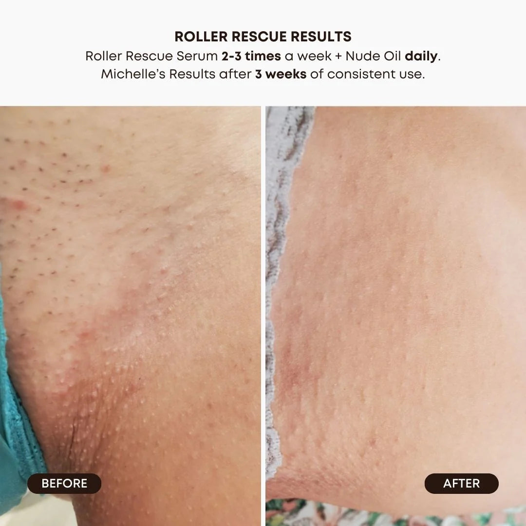 Roller rescue soothing serum