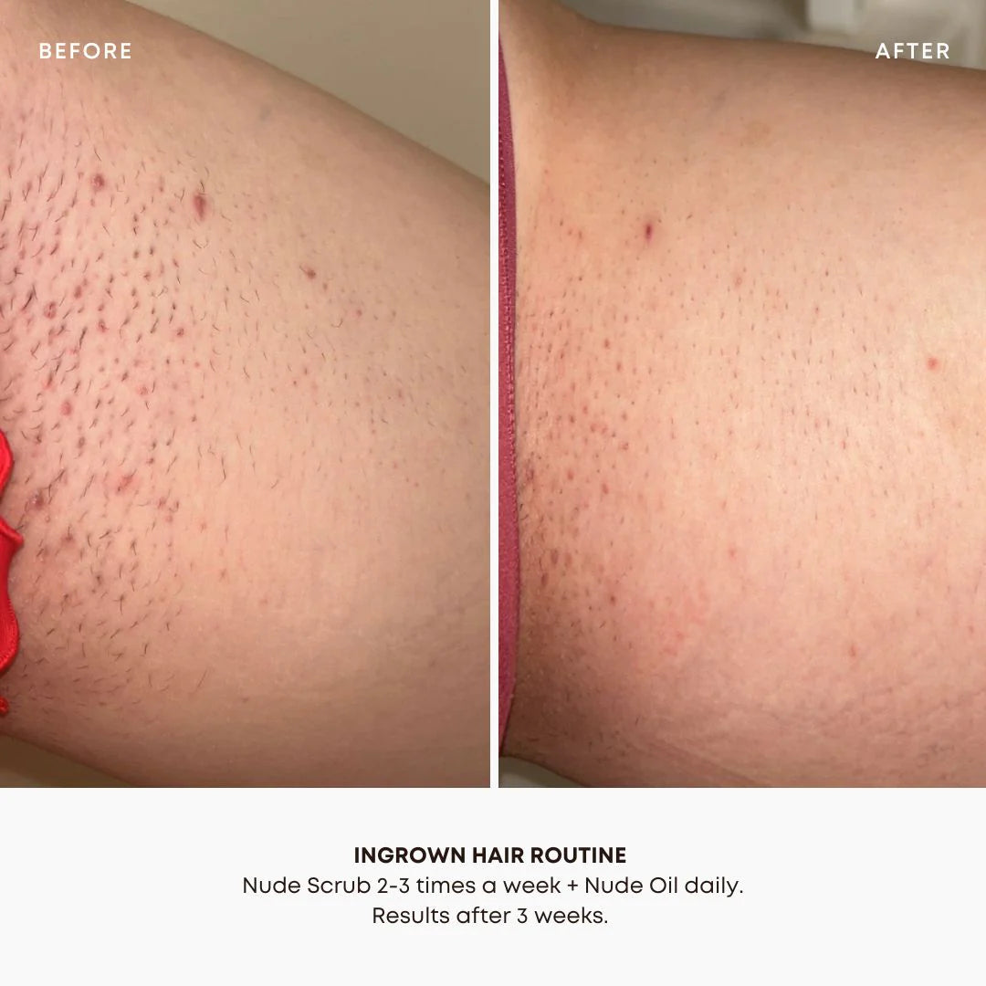 Ingrown hair oil Nude