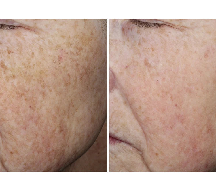 Pre-order COLLAGEN RESET REGIMEN with Tiered-Release Vesicle™ Technology ($504 value)