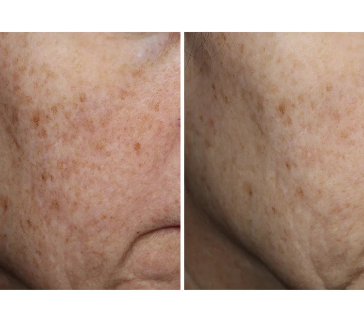 Pre-order COLLAGEN RESET REGIMEN with Tiered-Release Vesicle™ Technology ($504 value)