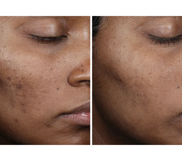 Pre-order COMPLEXION BRIGHTENING SERUM Tiered-Release Vesicle™ Technology