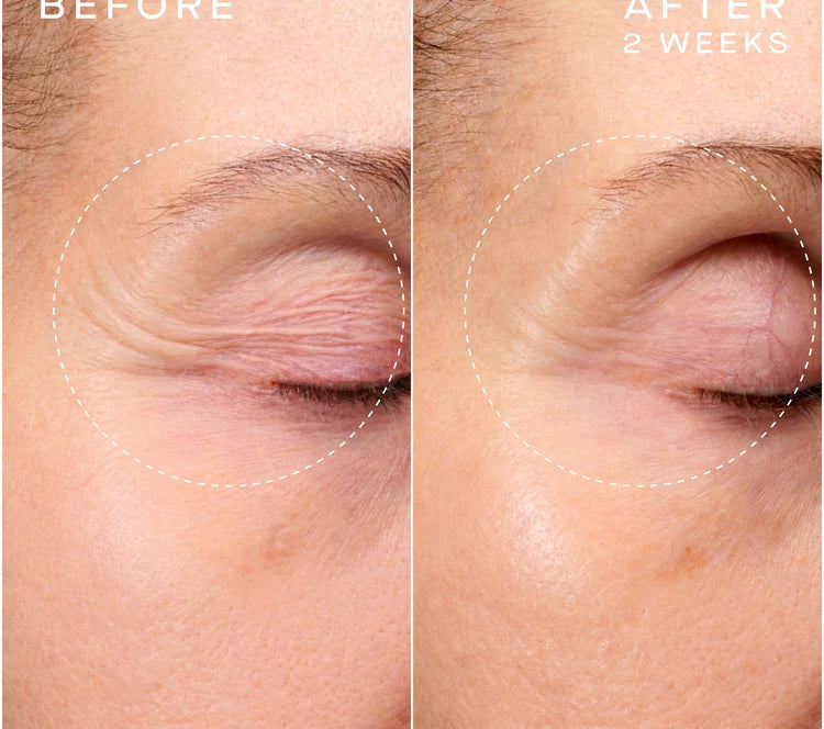 Pre-order ADVANCED REGENERATIVE SERUM 30MLwith Tiered-Release Vesicle™ Technology