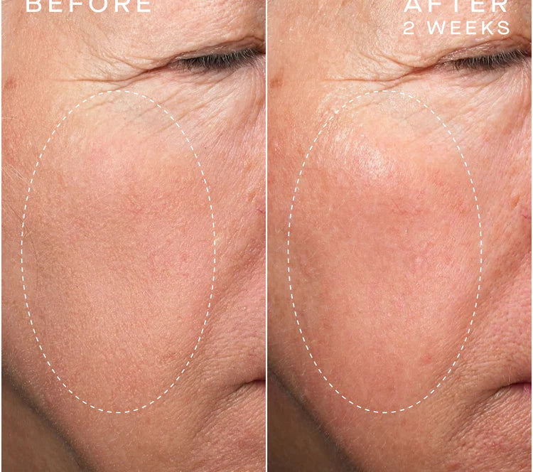 Pre-order ADVANCED REGENERATIVE SERUM 30MLwith Tiered-Release Vesicle™ Technology