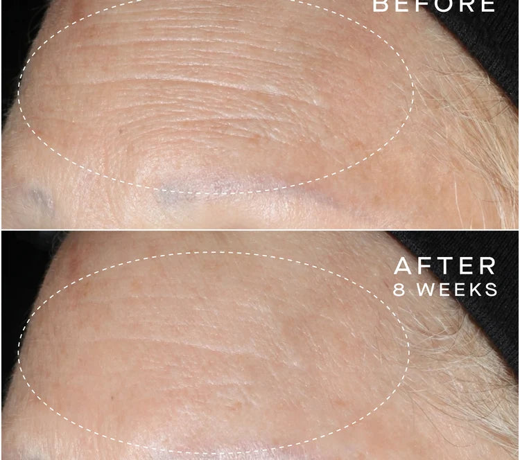 Pre-order ADVANCED REGENERATIVE SERUM 30MLwith Tiered-Release Vesicle™ Technology