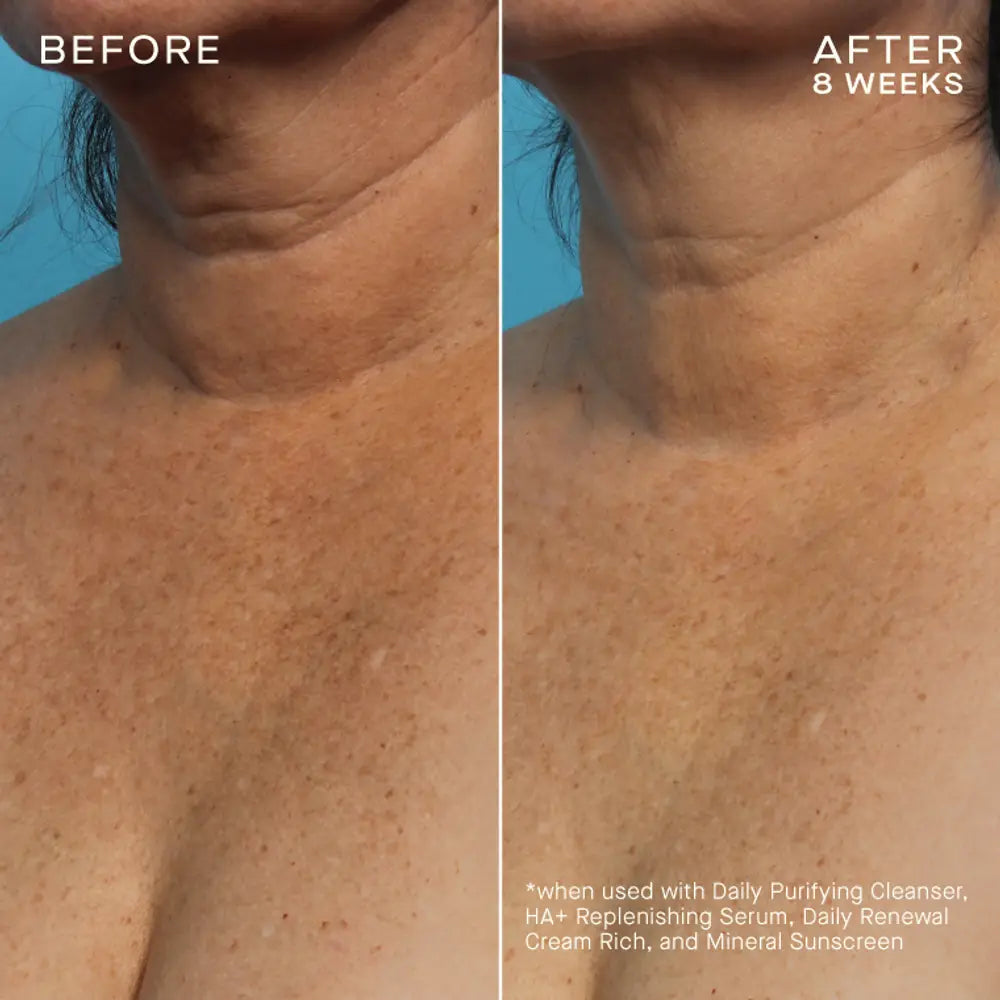 Pre-order COMPLEXION BRIGHTENING SERUM Tiered-Release Vesicle™ Technology