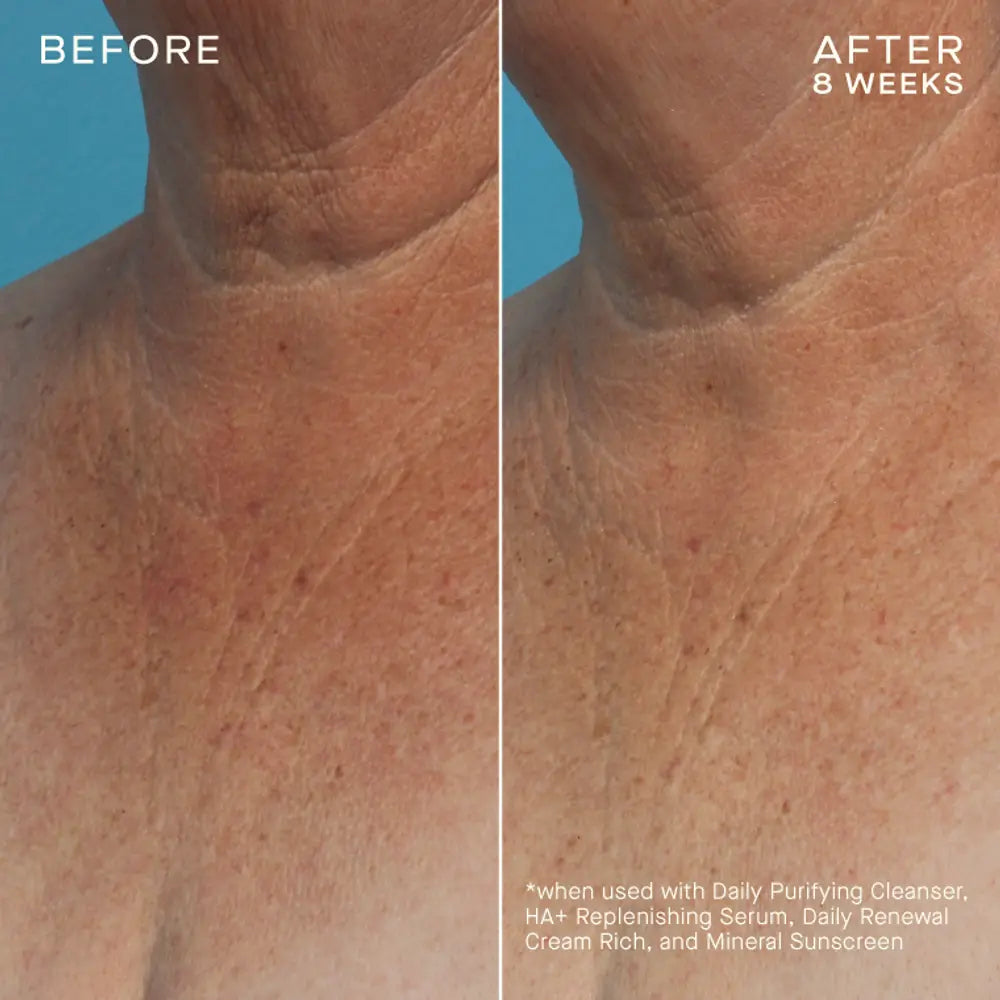 Pre-order COMPLEXION BRIGHTENING SERUM Tiered-Release Vesicle™ Technology