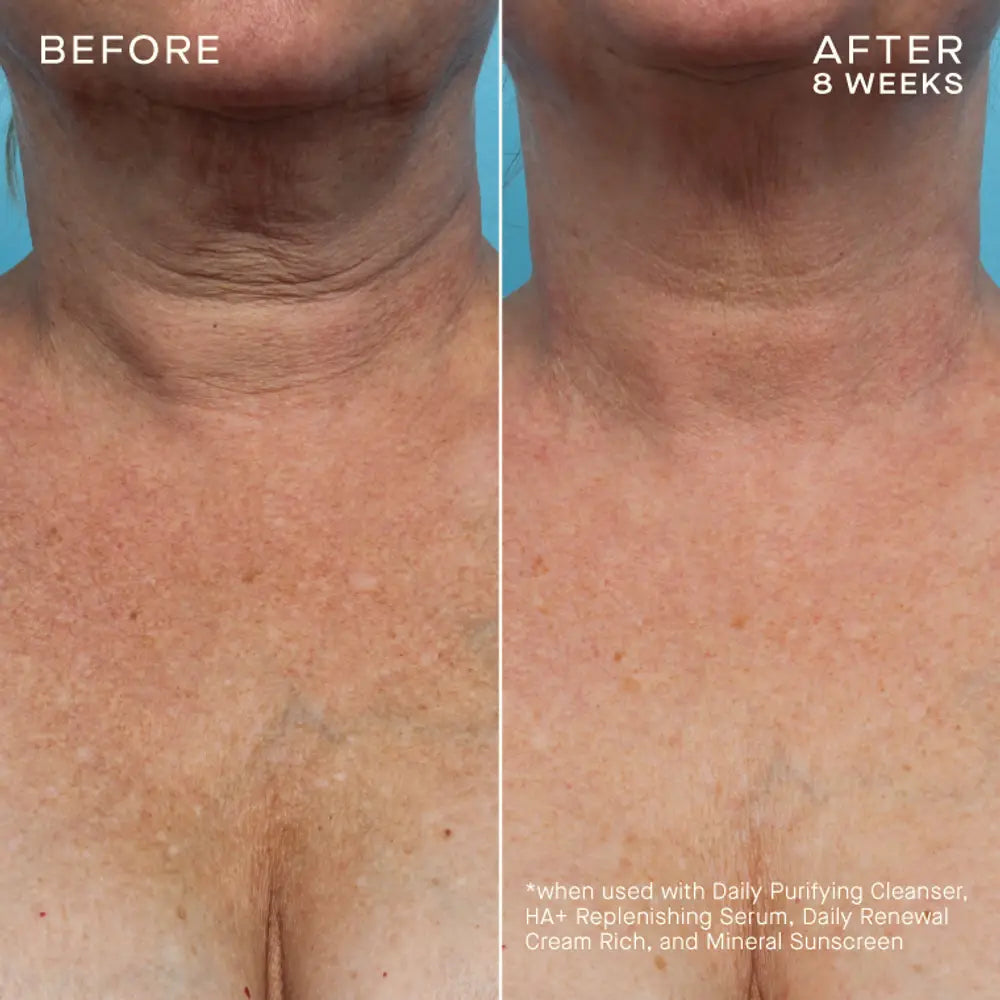 Pre-order COMPLEXION BRIGHTENING SERUM Tiered-Release Vesicle™ Technology