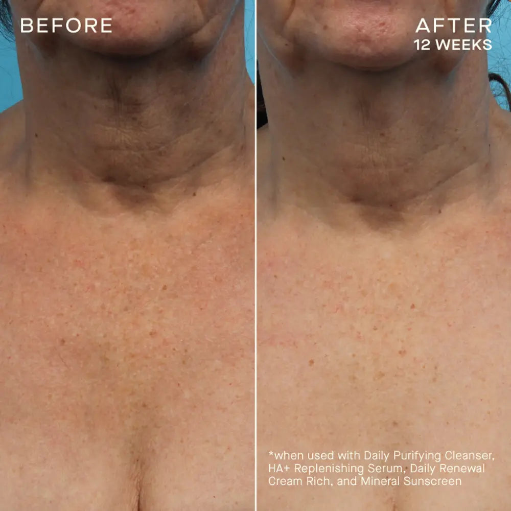 Pre-order COMPLEXION BRIGHTENING SERUM Tiered-Release Vesicle™ Technology