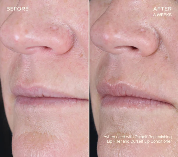 Pre-order REPLENISHING LIP FILLER Tiered-Release Vesicle Delivery Technology™