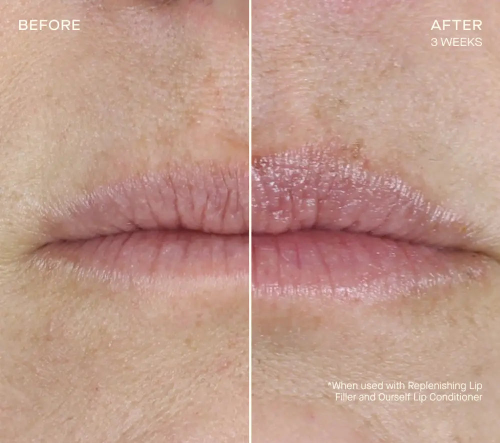 Pre-order REPLENISHING LIP FILLER Tiered-Release Vesicle Delivery Technology™