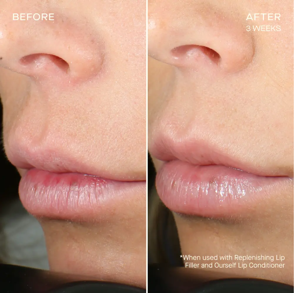 Pre-order REPLENISHING LIP FILLER Tiered-Release Vesicle Delivery Technology™
