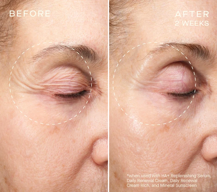 Pre-order COLLAGEN RESET REGIMEN with Tiered-Release Vesicle™ Technology ($504 value)